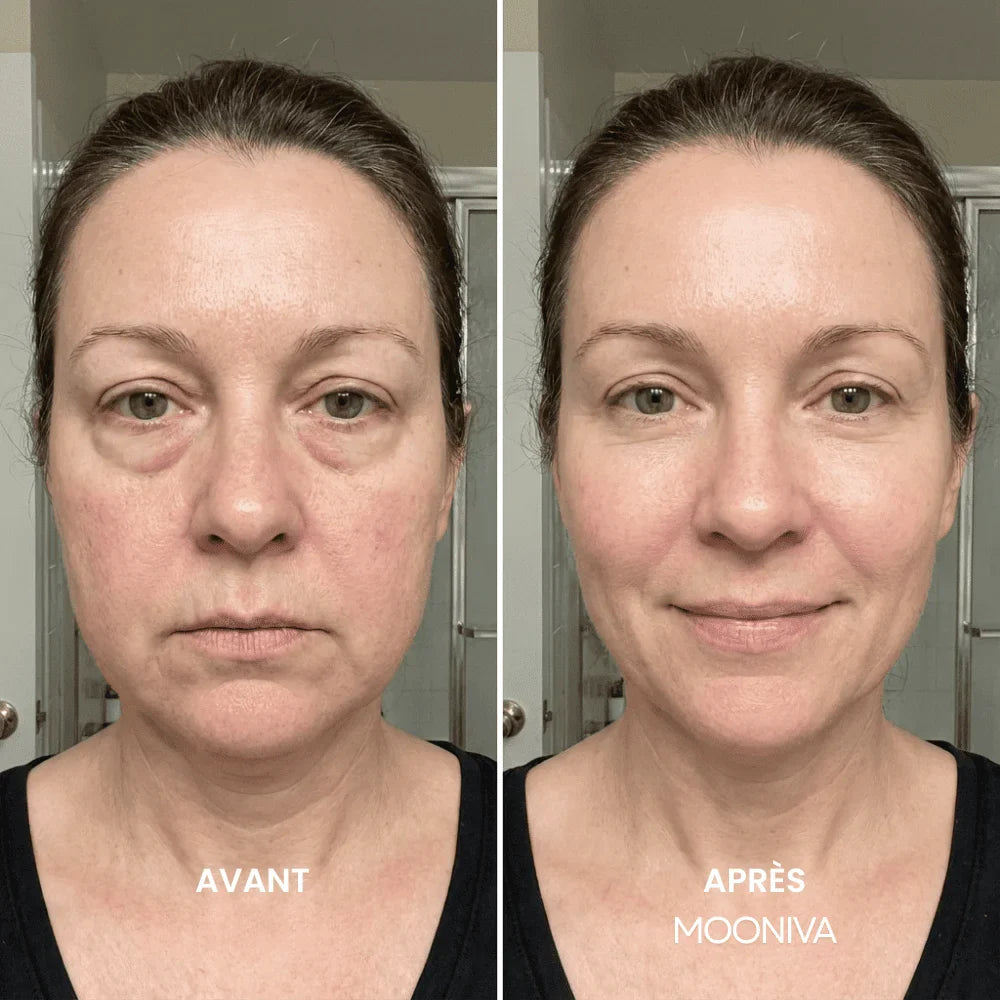 LuzSculpt™ - Brosse Lymphatique