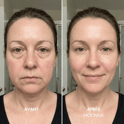 LuzSculpt™ - Brosse Lymphatique